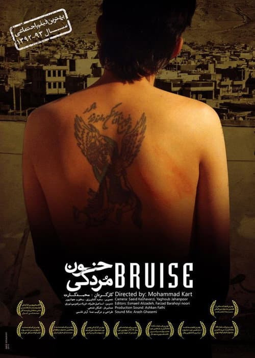 Bruise